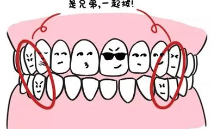 上海松丰齿科矫正多少钱?价格的高低和哪些因素有关?牙矫正对比图