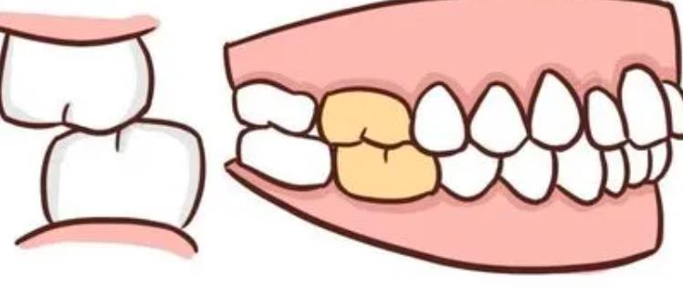 上海鼎植口腔医生谁的技术可靠点?口碑医生资料介绍!科普篇