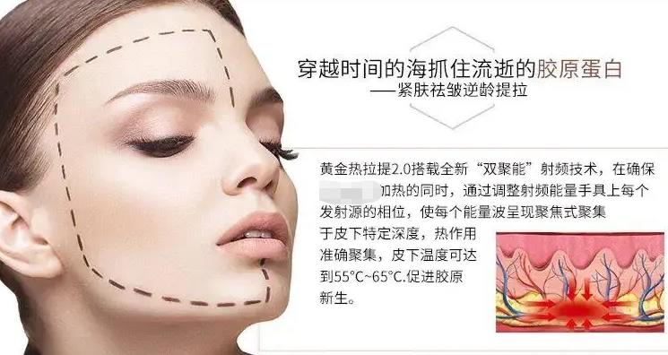 热拉提的功效与作用有哪些?紧肤、除皱等,轮廓固定的好选择~