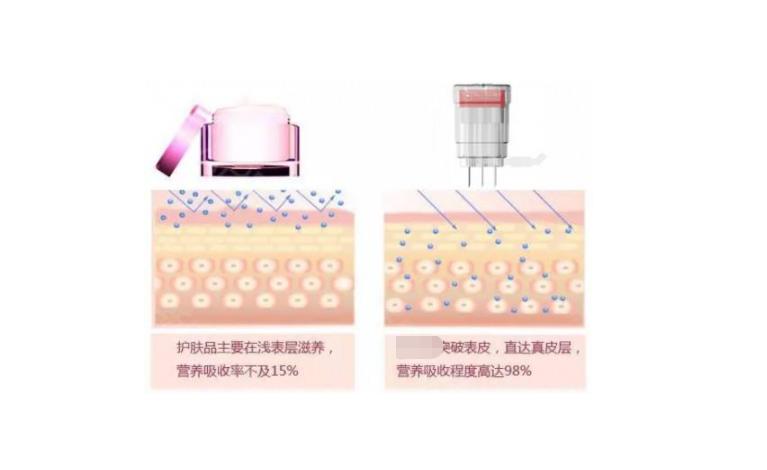 水光补水怎么做?优缺点在线分析!美肤小tips~
