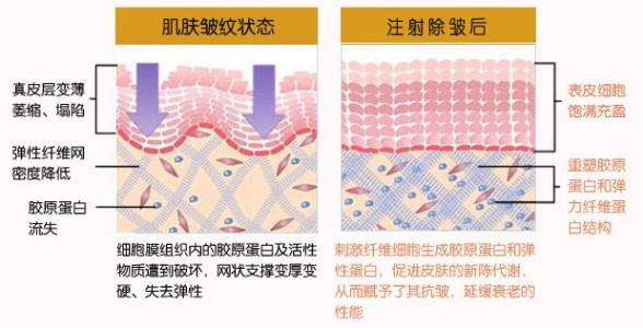 常州做热玛吉多少钱?拉皮除皱等价格收费明细刷新!抗老指南