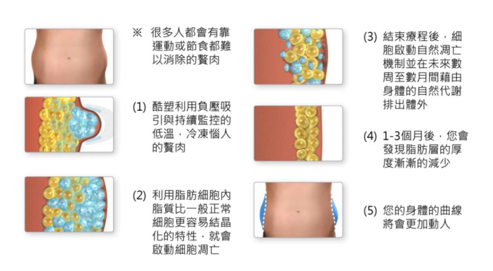 激光溶脂瘦脸的危害有哪些?刺痛、肿胀、疤痕等!附优点介绍