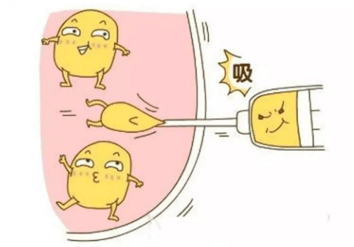 上海袁玉坤做抽脂咋样?全新价格表与抽脂案例详情!