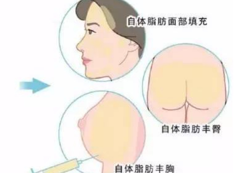 袁玉坤医生案例怎么样?医院坐诊医生实力点评