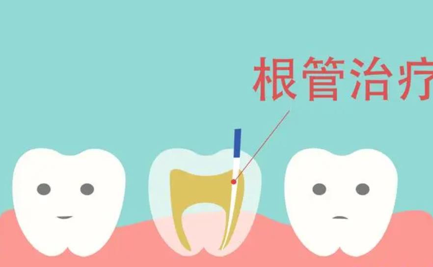 上海杨思医院牙齿根管调节技术好不好?哪些人比较适合做呢?