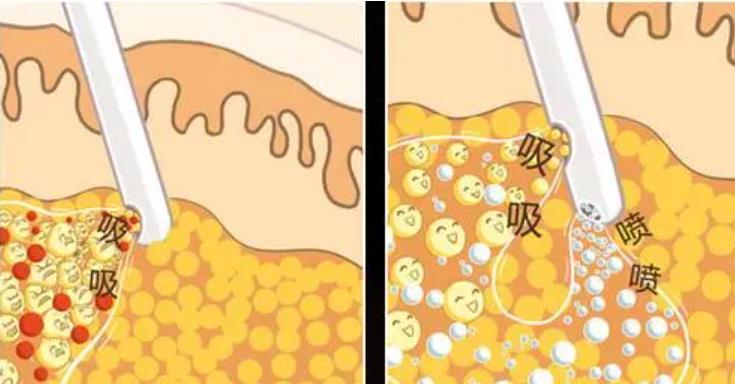 南京亿颜美美容医院怎么样?特色项目介绍!案例对比图曝光