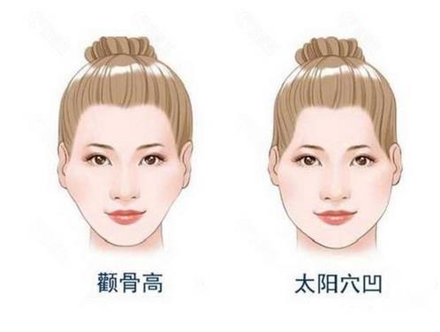 首尔丽格做颧骨内推要多少钱?价格表公布,附医院+医生简介