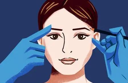 上海七星刘仁辉做眼睛怎么样?做双眼皮手术风格如何?案例参考