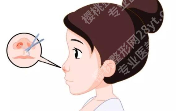上海娜慕医疗美容医院隆鼻多少钱?真人案例|价格表分享!就诊必看