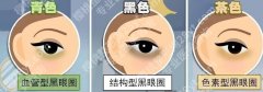 上海润悦医疗美容门诊部去黑眼圈多少钱？价格明细23年更新！