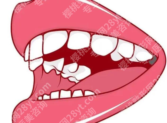 上海柏荟医疗美容门诊部丰唇多少钱?项目科普及注意事项盘点!