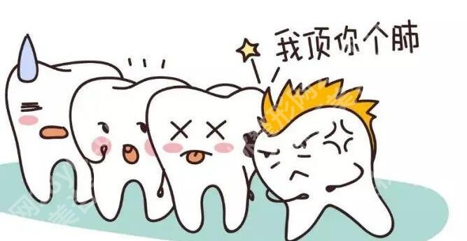 上海美康口腔门诊部正畸科怎么样?真人正畸效果图分享!