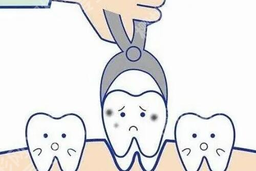 上海亿大口腔医院拔牙多少钱?医院口碑测评|医生名单!