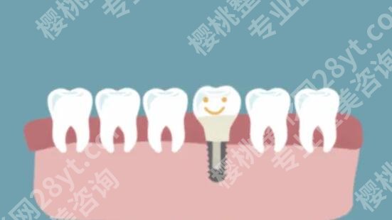 上海圣康口腔医院王斌医生口碑怎么样?医生实力点评|全新收费表参考!