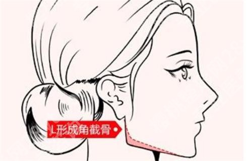 上海崔荣达磨骨怎么样?口碑不错,点击查看!