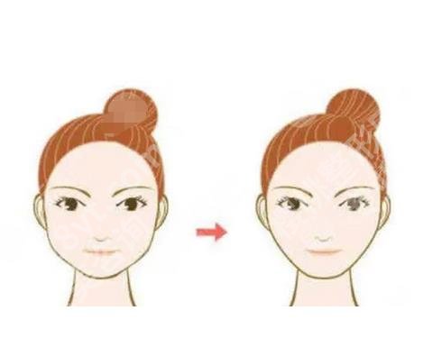 上海何晋龙磨骨怎么样?真实案例在线点评,价格表参考