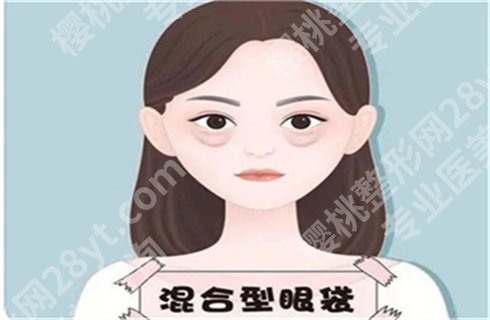 上海艺星医疗美容医院去眼袋好吗?口碑医生上线,技术不错哦
