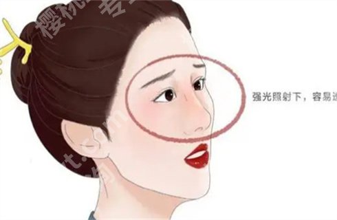 上海美莱游远榕做的鼻子图片分享!技术测评,案例详情一览