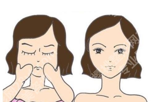 崔荣达案例分享!磨颧骨做的怎么样?收费价目表