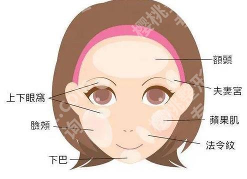 韩丽亚玻尿酸注射怎么样?玻尿酸丰面颊案例参考,一键看坠新价格