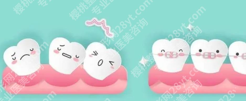 上海松丰口腔专科好吗?院内口碑医生推荐!牙齿整形效果图