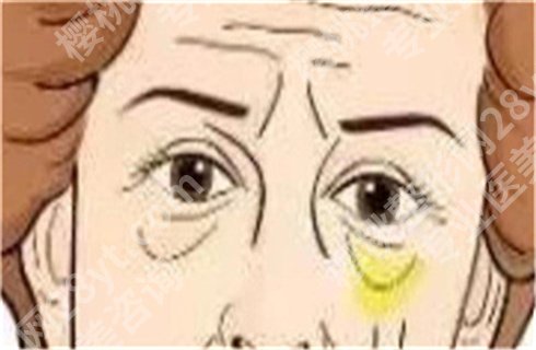 林华芬医生注射技术可靠吗?口碑不错,细节曝光!