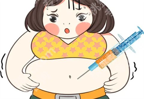 上海一美整形外科医院张墨林怎么样?吸脂瘦腰腹案例来了