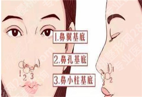 上海一美整形外科医院隆鼻价格表公布，隆鼻案例真人对比照，进入可查看