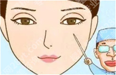 伊莱美朱迪割双眼皮好吗?术后1至3个月恢复图,速来围观