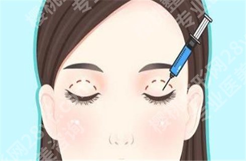 李静林双眼皮技术可靠吗?医院简介,细节分享,值得了解