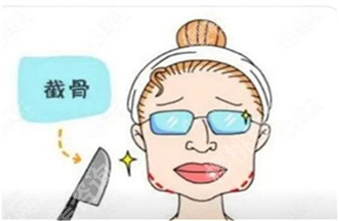 首尔丽格崔荣达磨骨案例?术前术后恢复图对比,值得收藏首尔丽格崔荣达磨骨案例?