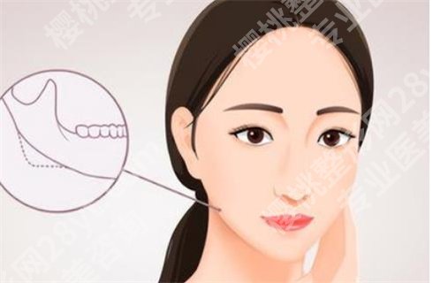 首尔丽格崔荣达磨骨案例?术前术后恢复图对比,值得收藏首尔丽格崔荣达磨骨案例?