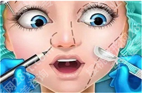 上海时光徐怀河做鼻子怎么样?术前术后恢复图对比!