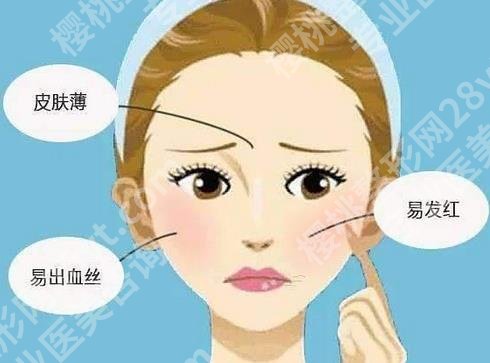 雅漾去红血丝有效吗?红血丝形成原因有哪些?速速了解