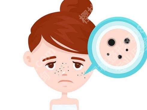 祛痘印好方法有哪些?痘印形成的原因有哪些?进来查看