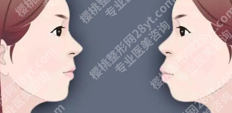 朴兴植正颌案例图片|坐诊医院基本资料介绍!正颌案例图