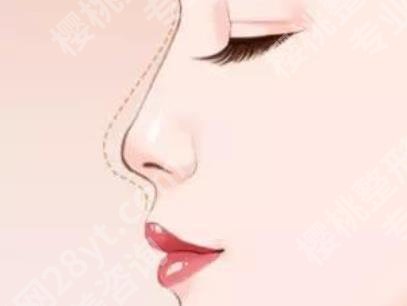 上海时光整形外科医院徐怀河怎么样?技术优势是什么?案例曝光