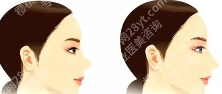 上海时光整形外科医院徐怀河怎么样?技术优势是什么?案例曝光