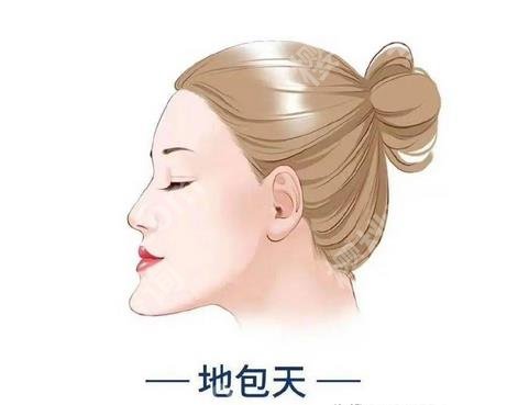 下巴前突怎么办?下巴前突的原因有哪些?速速看介绍