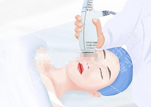 热拉提plus做一次可以维持多久?热拉提plus有哪些作用?