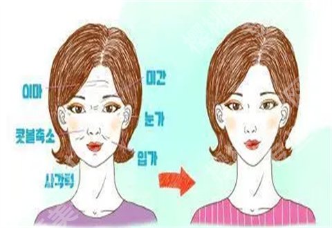 赛诺龙5gmax作用原理是什么?作用是什么?操作流程分享了