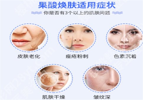 果酸的作用有哪些?操作流程复杂吗?整理相关知识点