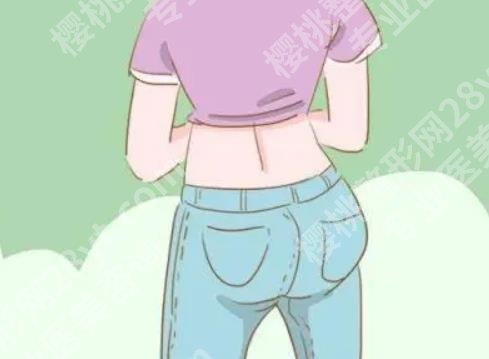 臀部吸脂手术多久可以恢复 ?臀部吸脂手术完成后需要穿塑身衣吗?
