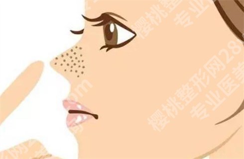哪种黑头导出液好用?好用的导出液合集啦,速来围观啦!