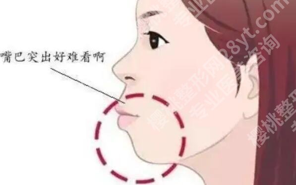 上海朴兴植正颌技术怎么样?医生简介|全新价格表参考!