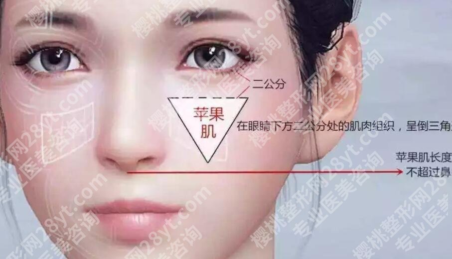 苹果肌断层有啥办法解决?有什么需要注意的事项吗?
