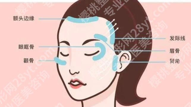 什么是筋膜悬吊面部提升术?原理及费用介绍!收藏再看