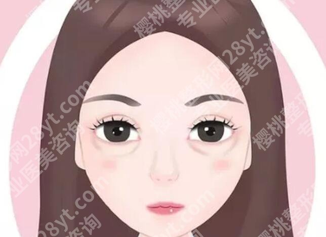 双美胶原蛋白填充泪沟能维持多久?大约需要多久恢复?