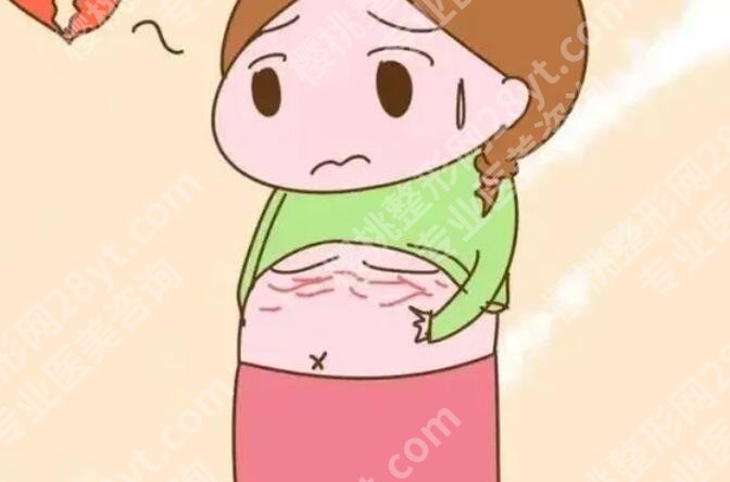腹部拉皮和腹壁整形哪个好?二者区别有哪些?收藏再看