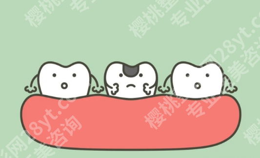 大牙镶牙好还是种植牙好呢？种植牙调节周期比较长费用相对较高！